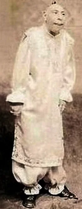Schlitzie